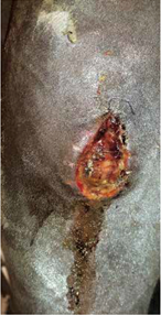 Herida quirúrgica de la rodilla 01 Darasyl
