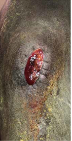 Herida quirúrgica de la rodilla 02 Darasyl