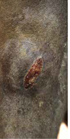 Herida quirúrgica de la rodilla 03 Darasyl
