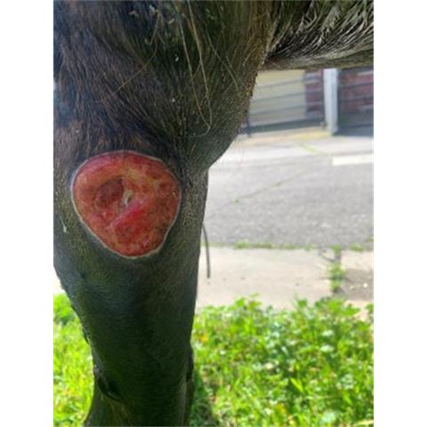 Vasculitis cutánea 02 Darasyl